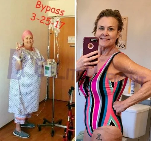 Sheree C - 1 Year Update *